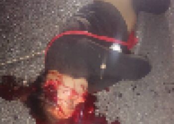 Trágico accidente en moto: dos fallecidos y un niño herido en Güigüe