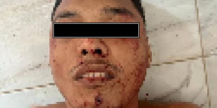 Cuerpos de seguridad abatieron en Tocuyito a líder de la banda «Maikel Seco»