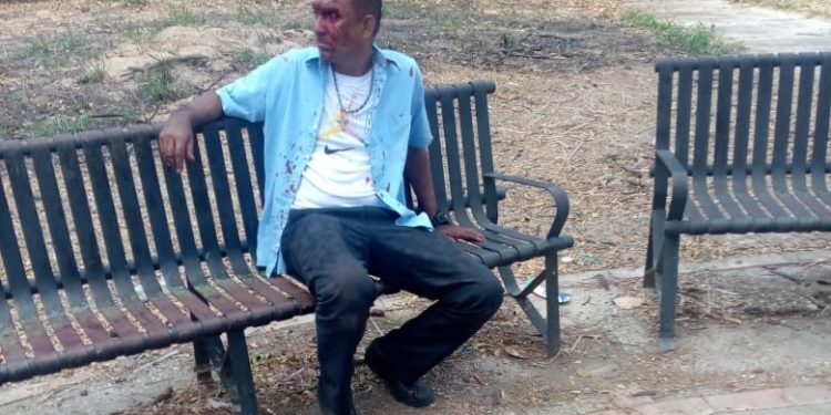 ¡Casi lo matan! Chofer de autobus intentó violar a estudiante de la UC