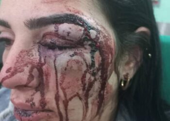 Naila, víctima de violencia doméstica pide cárcel para su agresor