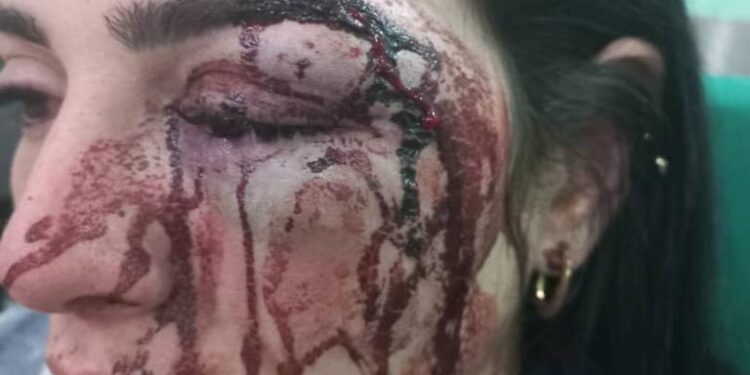 Naila, víctima de violencia doméstica pide cárcel para su agresor