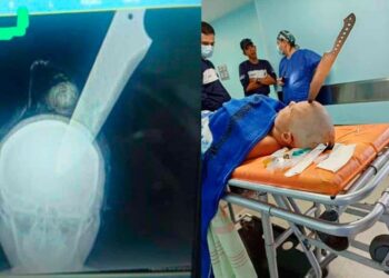 Operan a una mujer para extraerle un cuchillo de la cabeza en Aragua