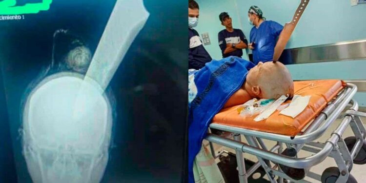 Operan a una mujer para extraerle un cuchillo de la cabeza en Aragua