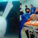 Operan a una mujer para extraerle un cuchillo de la cabeza en Aragua