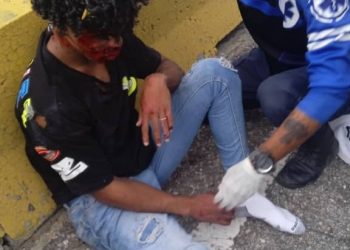 Dos jóvenes heridos en colisión de motos en Autopista del Este