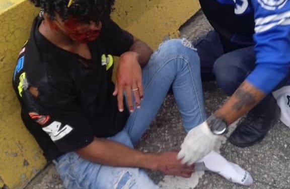 Dos jóvenes heridos en colisión de motos en Autopista del Este